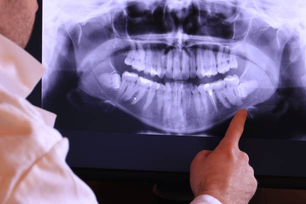 Best Weekend Emergency Dentist in Selma, NC
