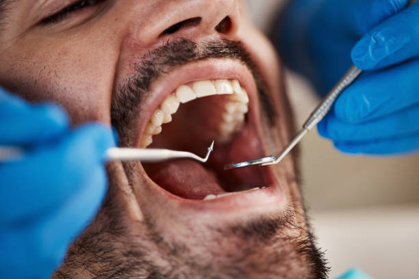 Best Broken or Cracked Tooth Emergency Dentist in Selma, NC
