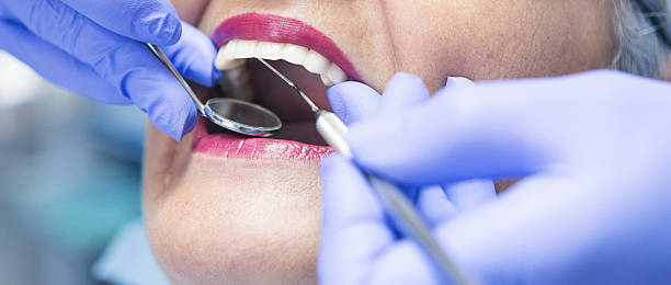 Best Emergency Dental Care for Abscessed Tooth in Selma, NC